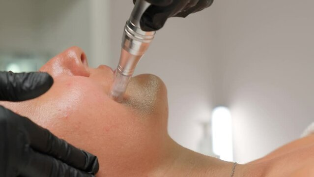 Close-up portrait of a beautiful aged woman during microneedling with dermapen from a beautician.