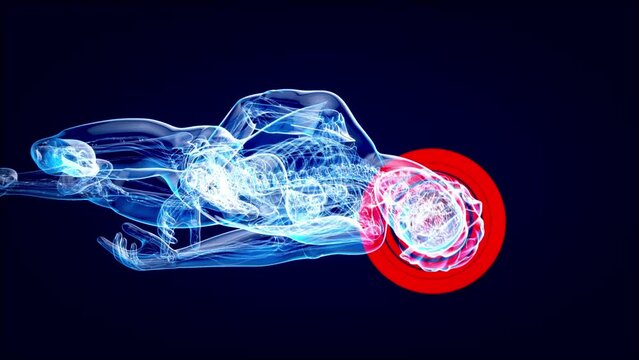 4K abstract animation of a Cyclist and a concussion