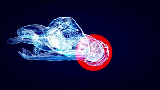 4K abstract animation of a Cyclist and a concussion