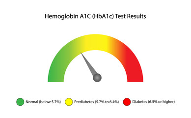 Hemoglobin A1C, HbA1c test results, glycated hemoglobin, A1C Blood Sugar Test, Diabetes Mellitus. Vector illustration.	
