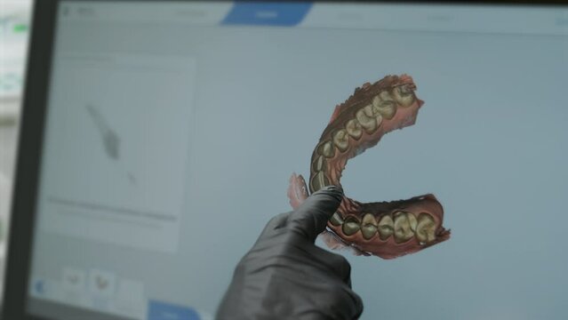 Doctor scans the patient's teeth in the clinic. The dentist holds in his hand a manual 3D scanner for the jaw and mouth. Dental health. Creates a 3D model of teeth and gums on a medical monitor.