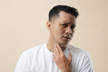 Fototapeta premium A Photo of Acne and pores on the face of a young Asian man. Improper therapy has led to a form of inflammation face and isolated on a cream background.