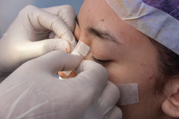 A cosmetic surgeon applies nose bridge bandage and mustache dressing after nasal surgery, septoplasty or rhinoplasty.