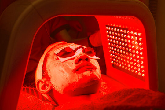 A female patient undergoes red LED light or RLT therapy for skin rejuvenation at an aesthetic clinic. Using a phototherapy device with red light wavelength for acne treatments and collagen production.