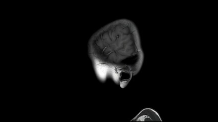 Magnetic resonance imaging(MRI) brain scan of a healthy 10 year old boy-lateral view, loop