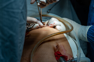 doctors, doctors and patient, doctor patient, doctor's office, doctor with patient, doctor computer, surgery operation, surgeon surgery, doctor surgery tools