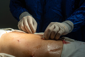 doctors, doctors and patient, doctor patient, doctor's office, doctor with patient, doctor computer, surgery operation, surgeon surgery, doctor surgery tools