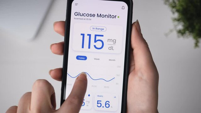 Monitoring glucose level with a smartphone app and a remote sensor. Continuous monitoring of glucose technology in diabetes treatment.
