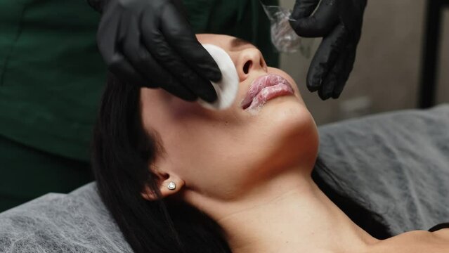 Cosmetology clinic, the doctor applies anesthesia to the patient's lips, anesthetic before injecting hyaluronic acid. Anesthetic ointment is applied before the injection procedure.