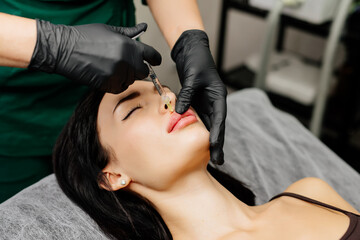 Close-up, woman's lips. A surgeon wearing medical gloves carefully and slowly injects hyaluronic...