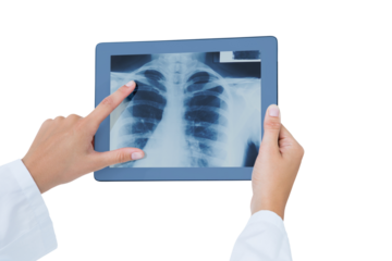 Digital png photo of doctor's hand holding tablet with lungs x-ray on transparent background