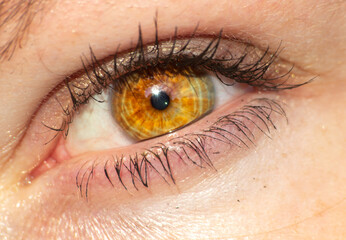 Oeil