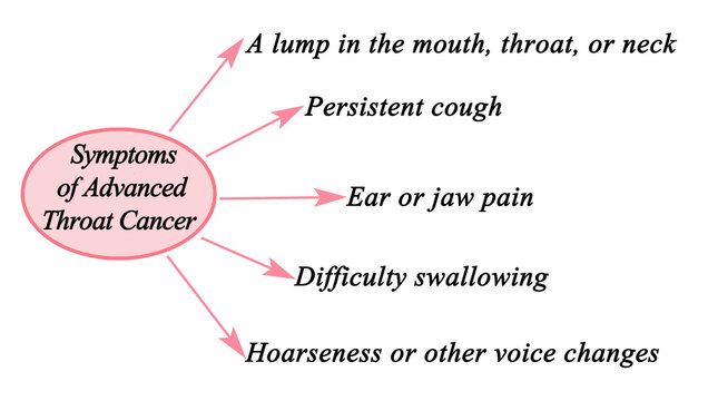  Symptoms of Advanced Throat Cancer