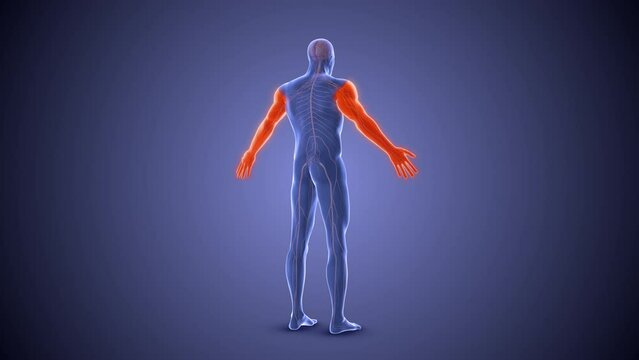 Diplegia paralysis condition medical concept