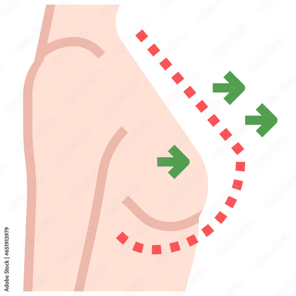 Poster BREAST AUGMENTATION filled outline icon,linear,outline,graphic,illustration