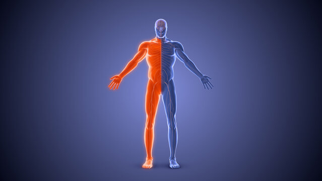 Hemiplegia paralysis condition medical concept