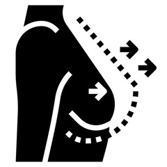 BREAST AUGMENTATION filled outline icon,linear,outline,graphic,illustration