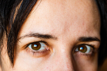 women's sore eyes, closeup