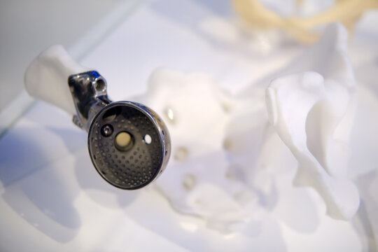 The artificial hip joint prosthesis allows individuals with hip disabilities to walking and running, promoting a healthy lifestyle.