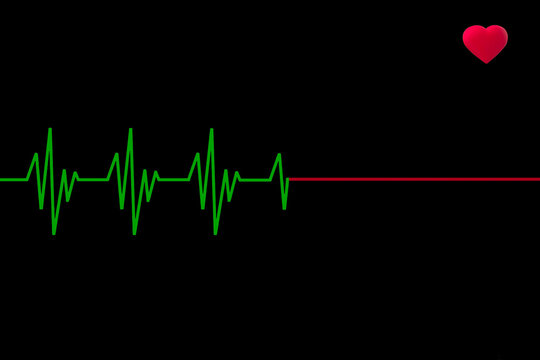 Heart beat cardiogram on monitor at death (of a person in cardiac arrest)
