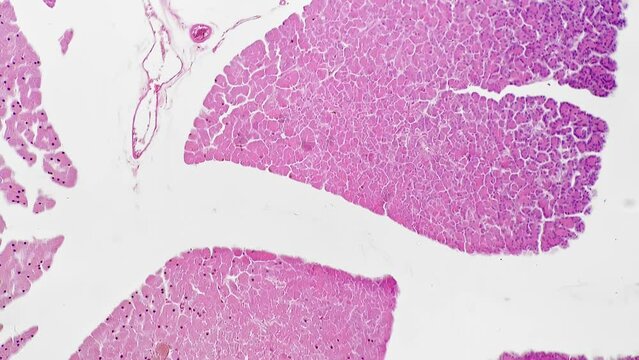 Macro scientific slide of human pancreas tissue magnified under microscope 100 on bright field background. Sample of digestive system organ located in the abdomen. Research of people anatomy concept