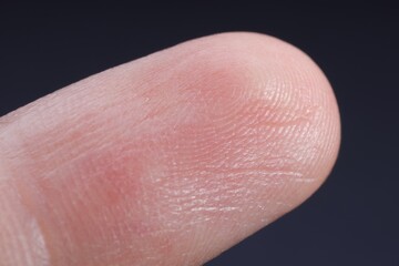 Finger with friction ridges on dark background, macro view