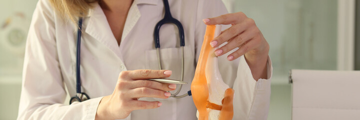 Female physiotherapist holds anatomical model of human knee joint. - obrazy, fototapety, plakaty