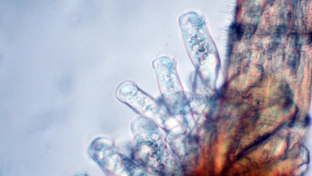 ciliates attached to a cyclops, colony of ciliates
