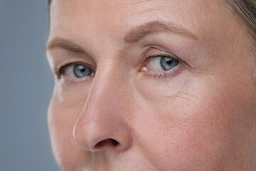 Senior woman with aging skin on grey background, closeup. Rejuvenation treatment