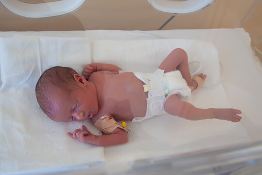 Premature Newborn Baby In The Hospital Incubator. Neonatal Intensive Care Unit