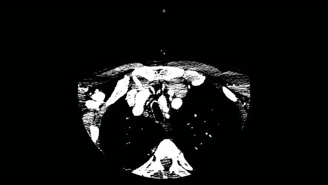 Magnetic resonance imaging of the brain. MRI of the brain. Medical examination of the human brain