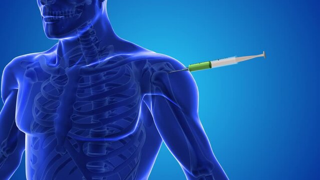 An animation shows stem cells being injected into a human shoulder