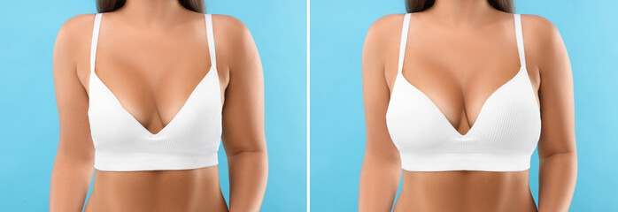 Woman before and after breast augmentation on light blue background, closeup. Collage with photos...