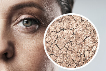 Middle-aged woman's face with magnified skin sample.Concepts of aging,  skin condition, and...