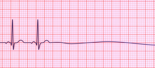 ECG in asystole, 3D illustration