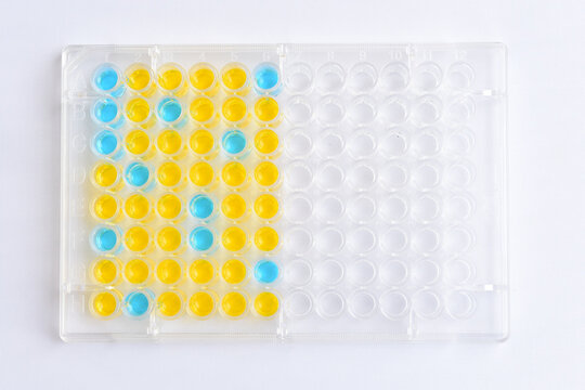 Enzyme-linked immunosorbent assay or ELISA plate, Immunology testing method in medical laboratory