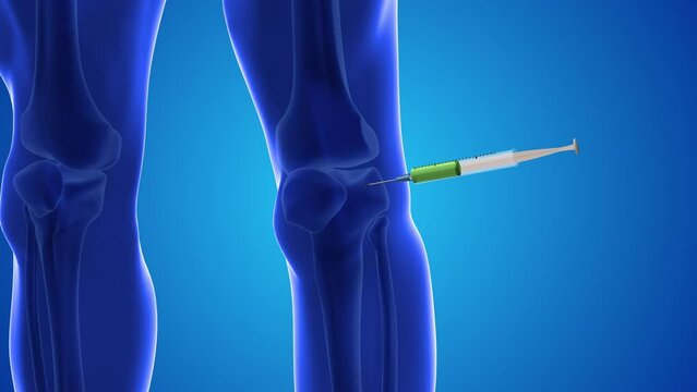 An animation shows stem cells being injected into a human knee