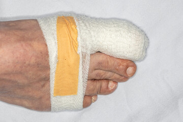 Closeup of man right foot with a wounded at big toe