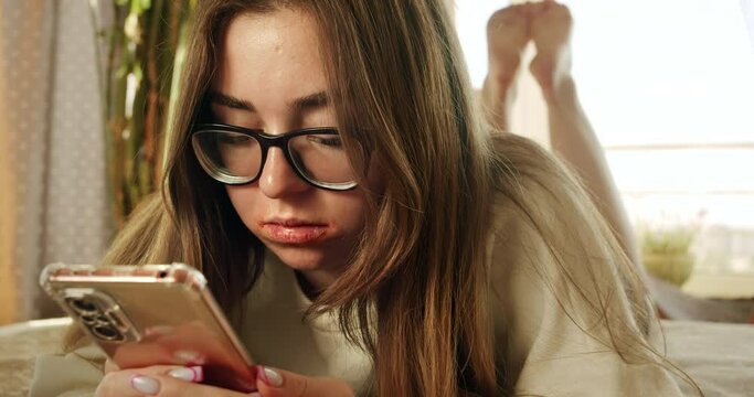 Cute girl, lovely young woman with lip problems, lip pimples, dryness using smartphone. Search for information about lip problems using a smartphone 