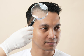 Portrait of a young Asian man with an acne problem and a magnifying glass, wearing a white t-shirt...