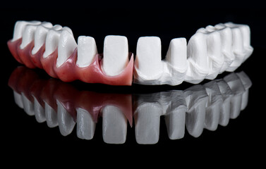 Obraz premium max natural look crowns on implants