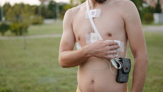 Arc shot of holter monitor sensors attached to naked body of slender man, outdoor . Studying functioning of heart and diagnosing diseases of cardiovascular system using portable medical device.