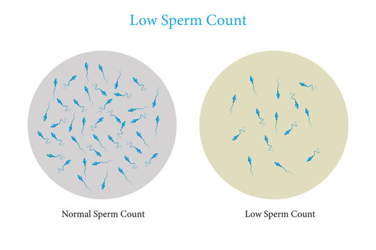 normal and low sperm count illustration. Vector illustration. eps 10
