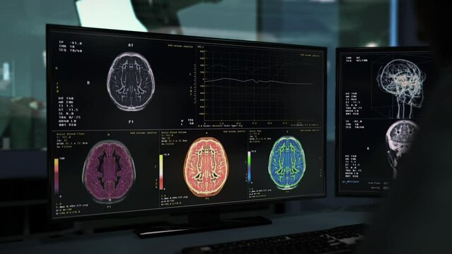 Brain diagnostic scanner analysing the head of the emergency patient. Scanner performs diagnostic procedure on the damaged brain organ. Diagnostic scanner studying the injuries in the brain.