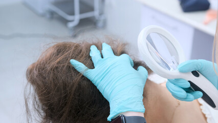 A trichologist examines the condition of the hair on the patient's head using a lens