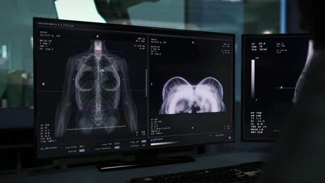 Medical imaging scanner analyzing the condition of female breast at a clinic. Medical imaging scanner examining the chest organs. Medical imaging mammography scanner searches for cancer in breasts.