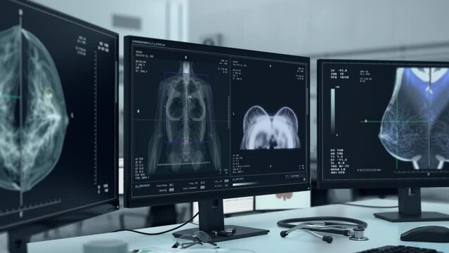 X-ray scanner searching for breast cancer traces in the female patient. Scanning the chest to detect breast cancer. Healthcare Scanner finds the deadly cancer cells in the woman patients breast.