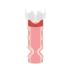 Tracheal stenosis awareness illustration. Trachea narrowing symbol. Difficulty breathing, hoarseness and voice change symptoms. Healthcare concept. Isolated flat vector illustration.