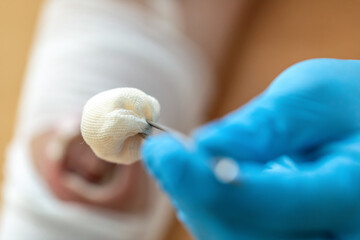 Wound care concept: Symbolizing change of dressing and cleaning and debridement of a wound with a...