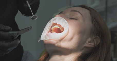 Dentist treats teeth, orthodontist fumbles in patient's mouth.